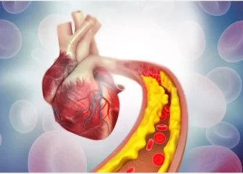 Symptoms of Stent Failure: How to Identify and Manage This Condition