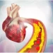 Symptoms of Stent Failure: How to Identify and Manage This Condition