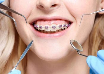 Understanding orthodontics and its evolution