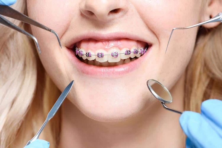 Understanding orthodontics and its evolution