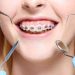 Understanding orthodontics and its evolution