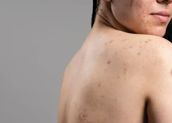 Understanding Diseases: Types, Causes, and Preventive Measures