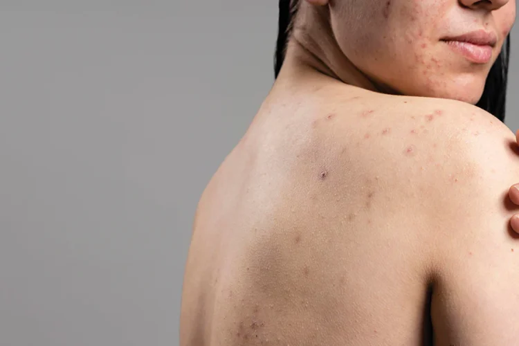 Understanding Diseases: Types, Causes, and Preventive Measures