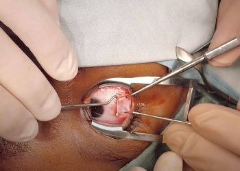 Surgery: In-Depth Insights into Modern Surgical Practices and Advancements