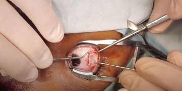 Surgery: In-Depth Insights into Modern Surgical Practices and Advancements