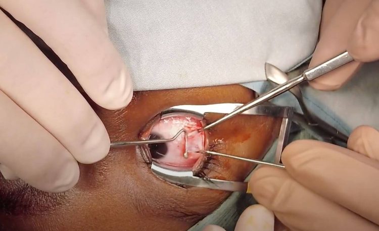 Surgery: In-Depth Insights into Modern Surgical Practices and Advancements