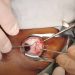 Surgery: In-Depth Insights into Modern Surgical Practices and Advancements