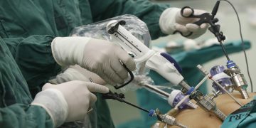 Minimally Invasive Surgery: Benefits and Limitations